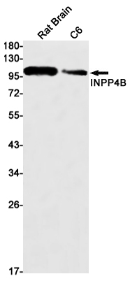 INPP4B Rabbit mAb ABZ3018