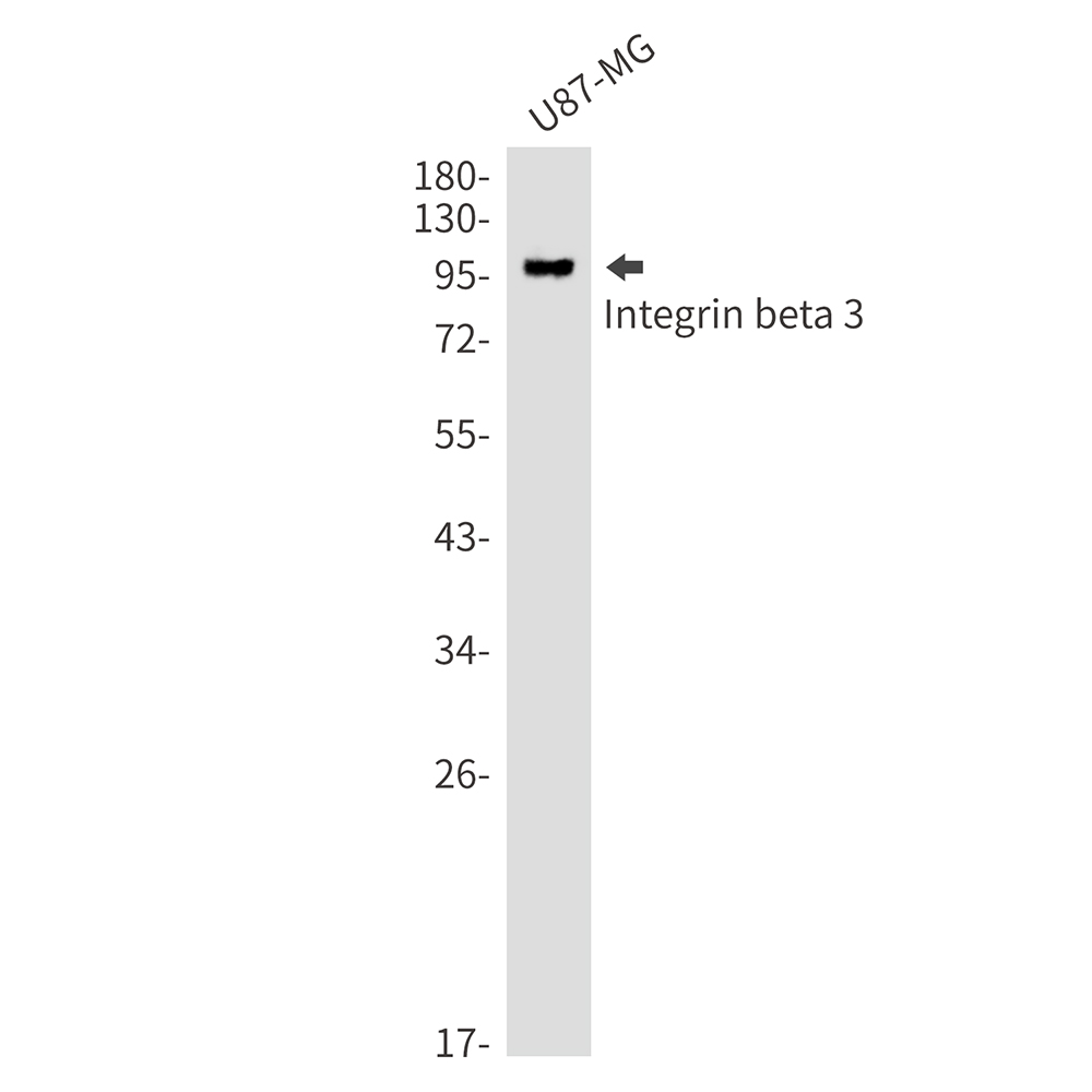 Integrin beta 3 Rabbit mAb ABZ3019