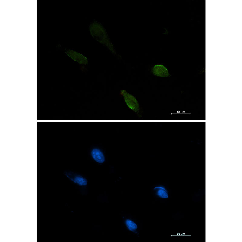 IRF1 Rabbit mAb ABZ3021
