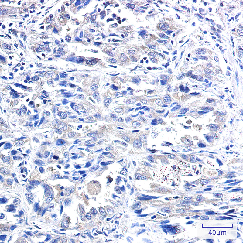 IRF1 Rabbit mAb ABZ3021