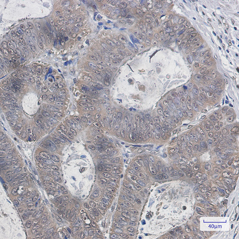 Ubiquitin K48 Rabbit mAb ABZ3025