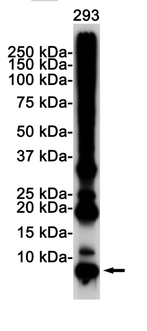 Ubiquitin K48 Rabbit mAb ABZ3025