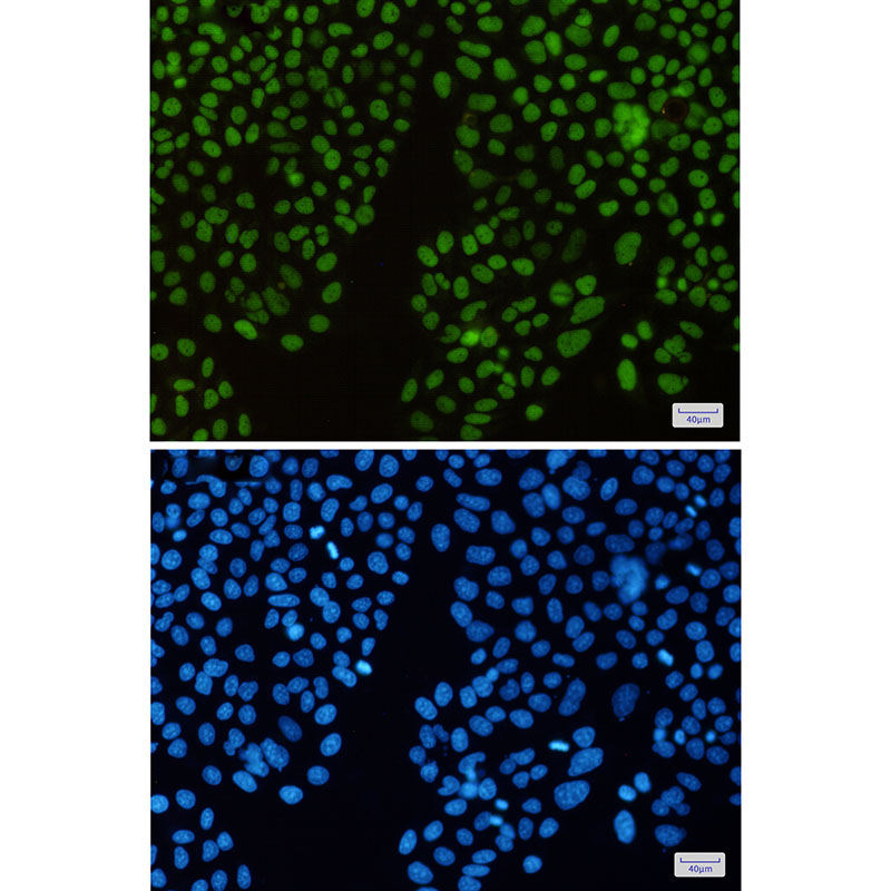 KAT1 Rabbit mAb ABZ3027