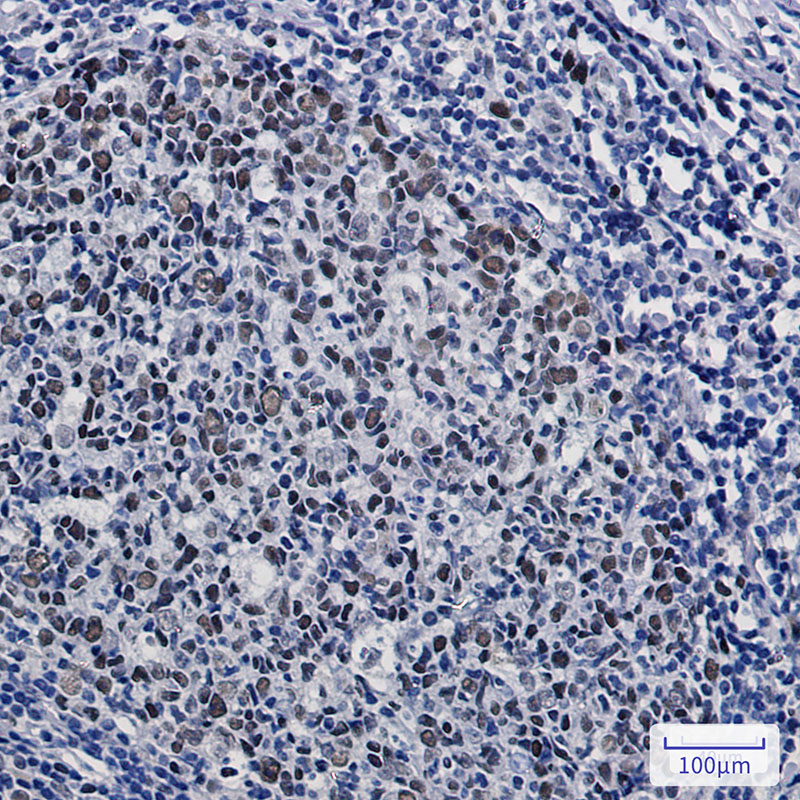 KAT1 Rabbit mAb ABZ3027