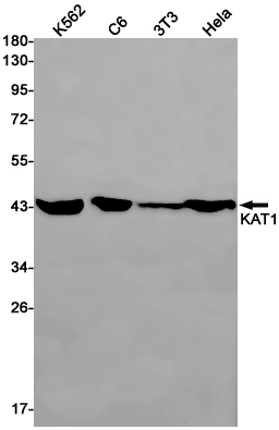 KAT1 Rabbit mAb ABZ3027