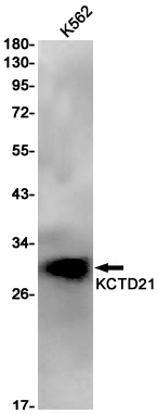 KCTD21 Rabbit mAb ABZ3028