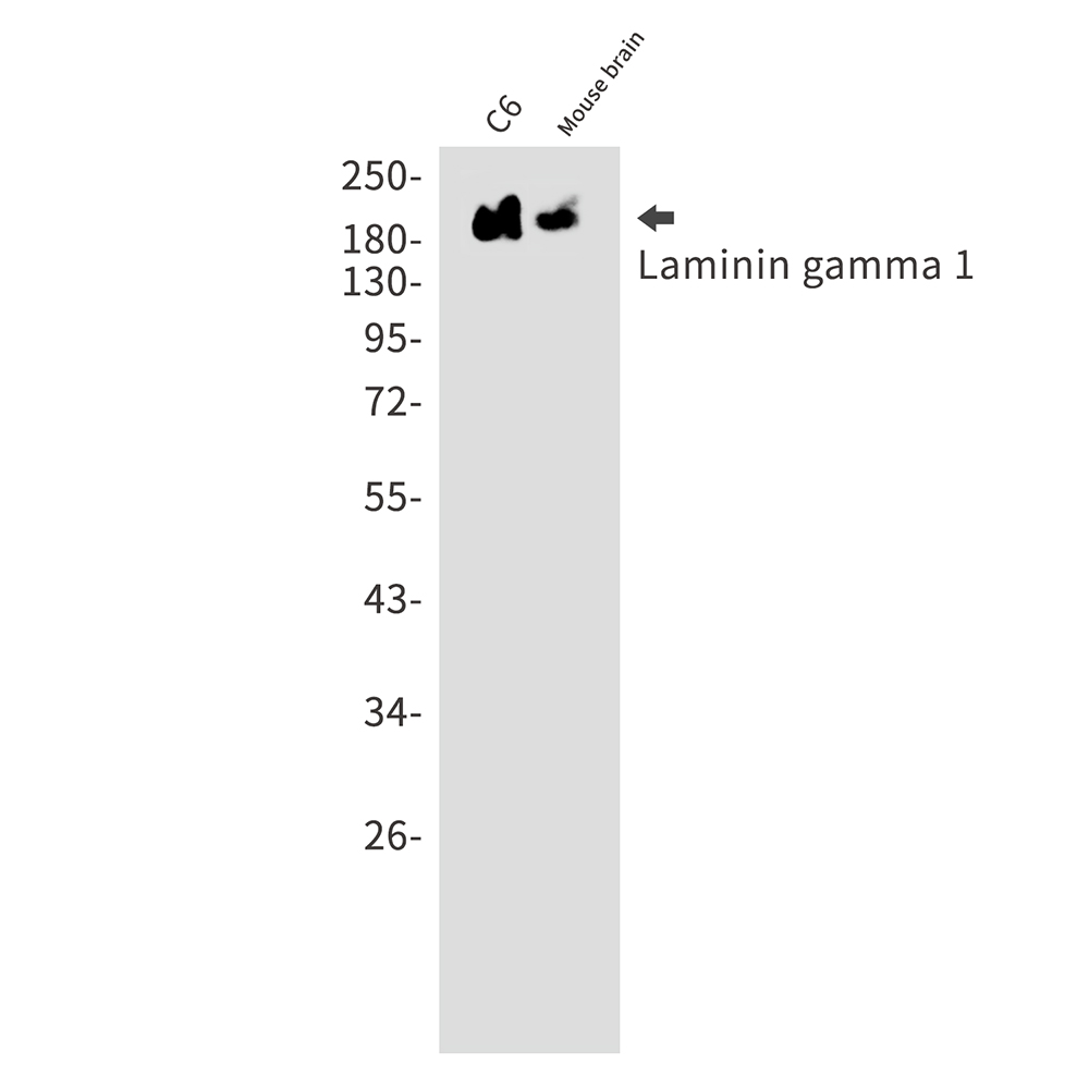 Laminin gamma 1 Rabbit mAb ABZ3034