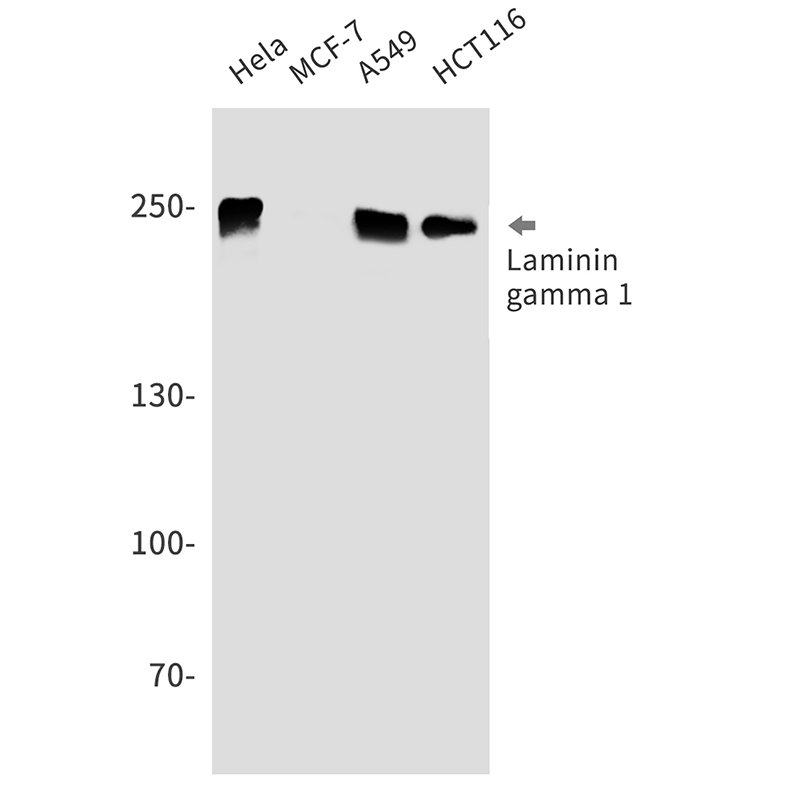 Laminin gamma 1 Rabbit mAb ABZ3034