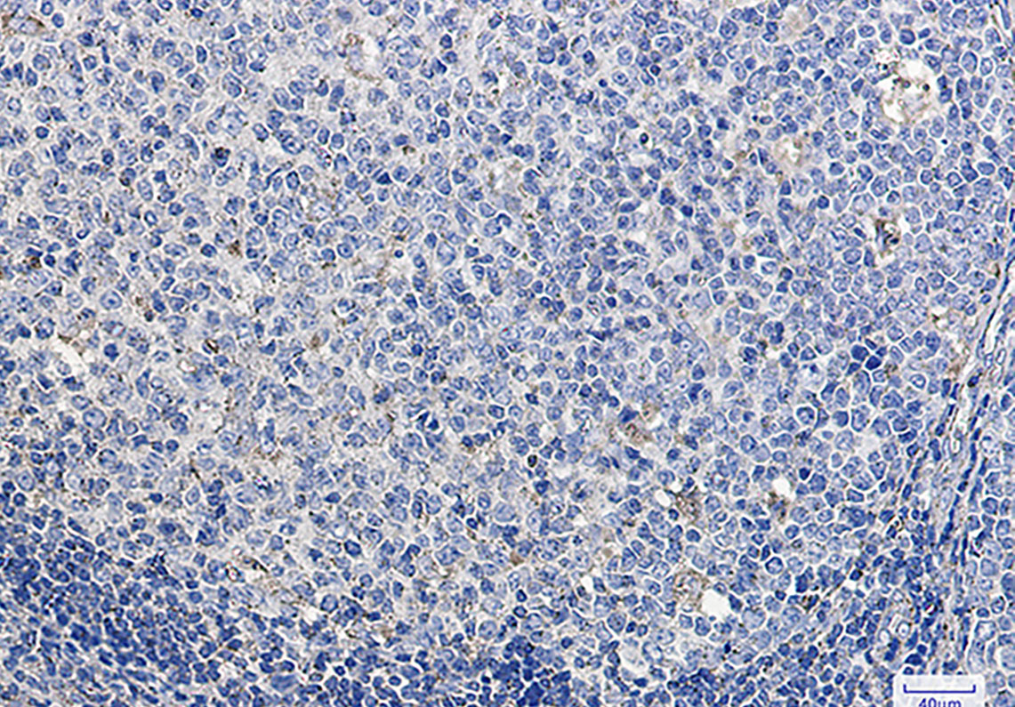 LAMP1 Rabbit mAb ABZ3035