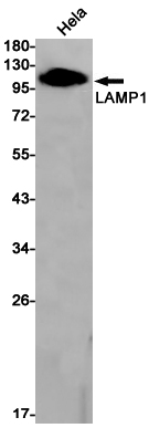 LAMP1 Rabbit mAb ABZ3035