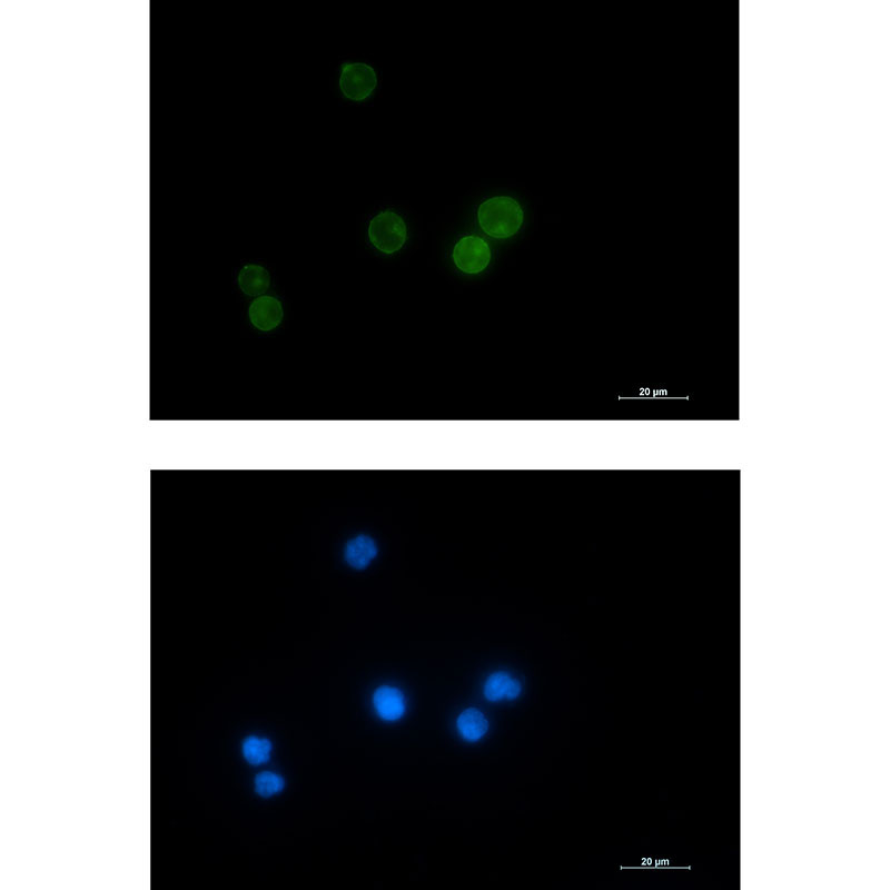 Lck Rabbit mAb ABZ3037