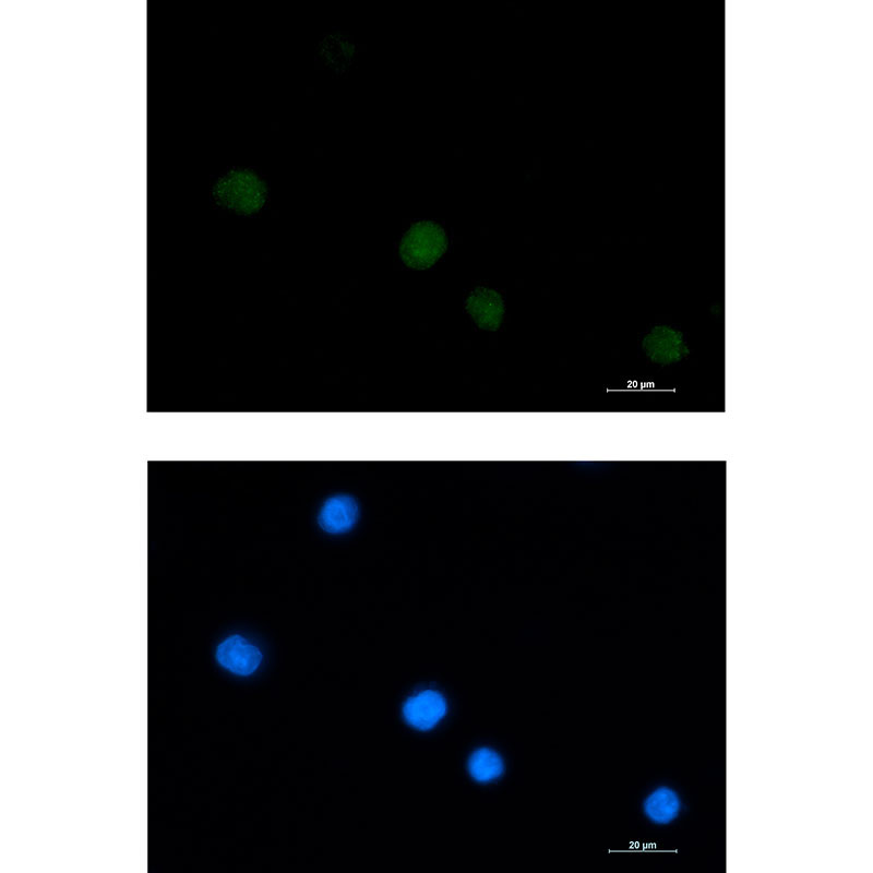 LGALS14 Rabbit mAb ABZ3039