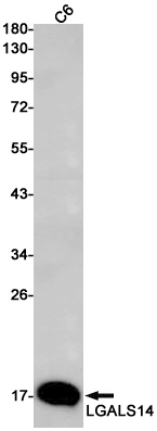 LGALS14 Rabbit mAb ABZ3039