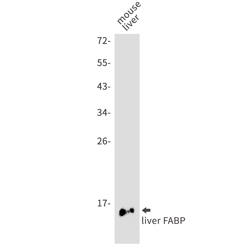 liver FABP Rabbit mAb ABZ3040