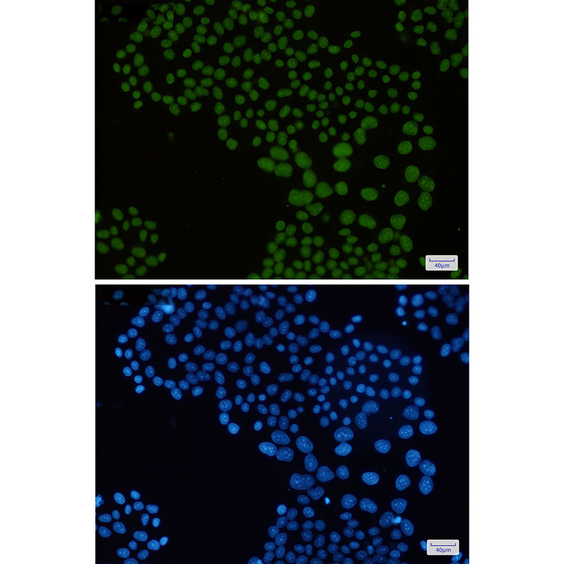 mH2A1 Rabbit mAb ABZ3042