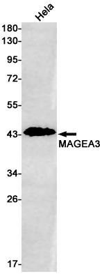 MAGE3 Rabbit mAb ABZ3043