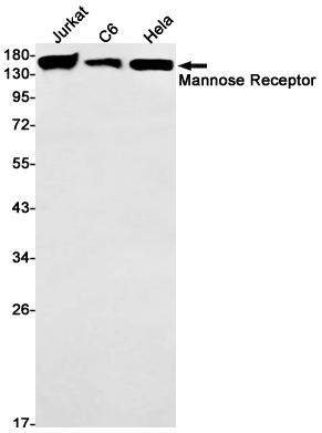Mannose Receptor/CD206 Rabbit mAb ABZ3044