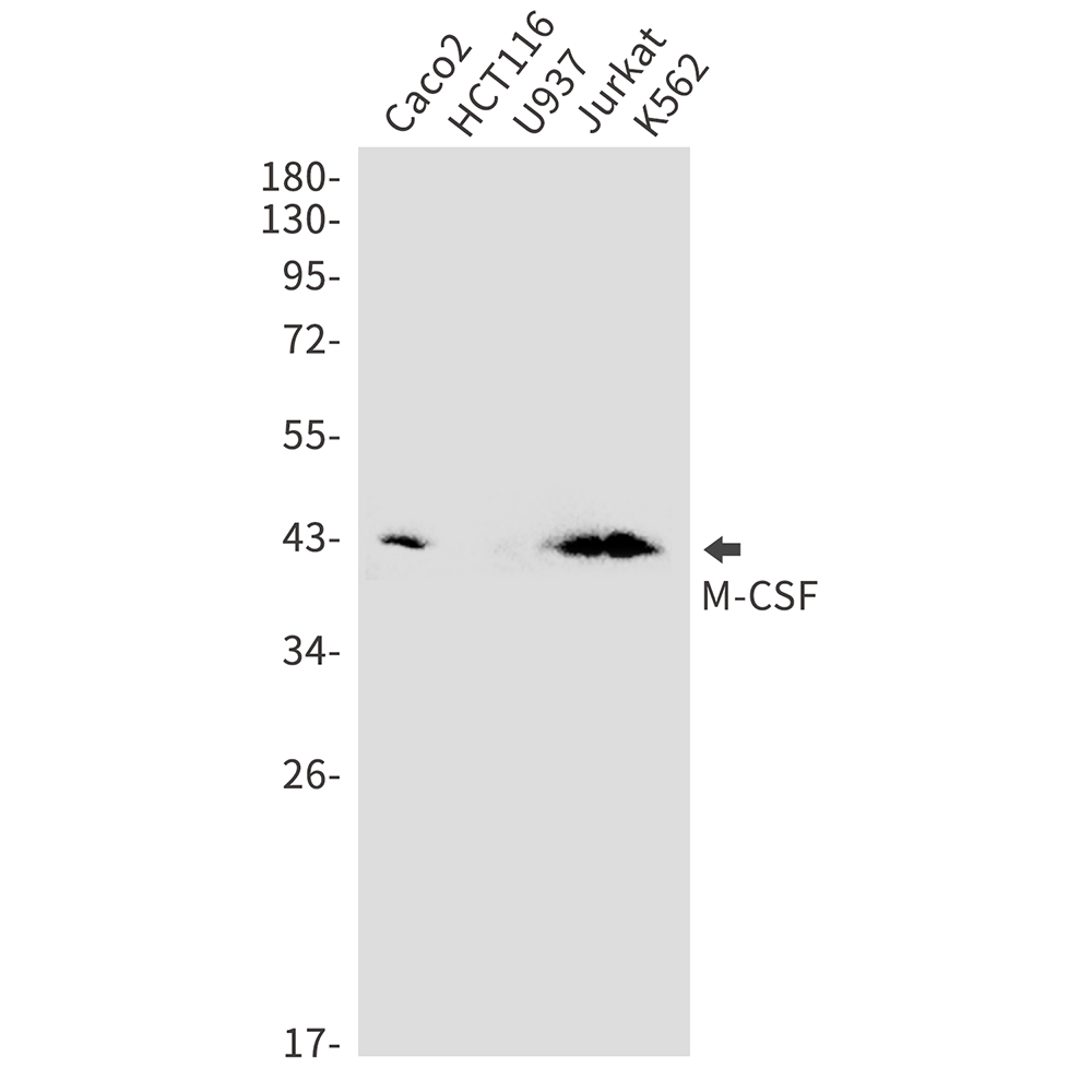 M-CSF Rabbit mAb ABZ3045