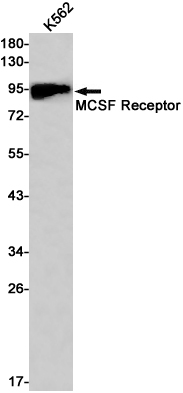 CSF1R/CD115 Receptor Rabbit mAb ABZ3046