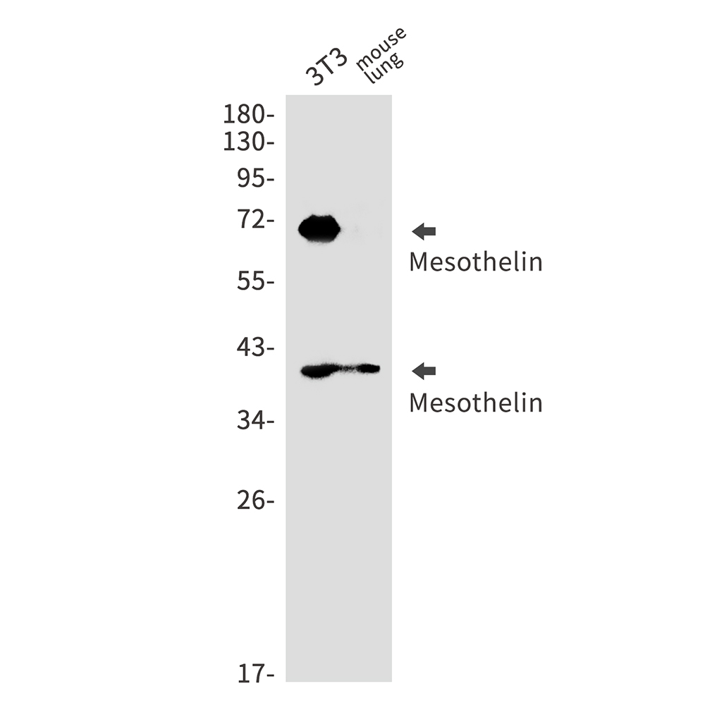 Mesothelin Rabbit mAb ABZ3047