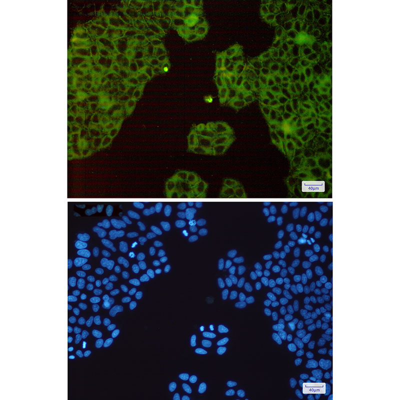 c-Met Rabbit mAb ABZ3048
