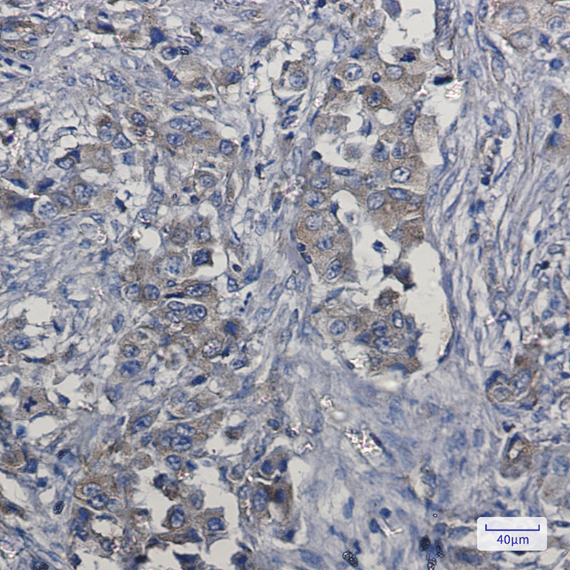 c-Met Rabbit mAb ABZ3048