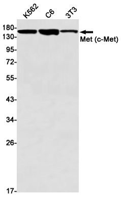 c-Met Rabbit mAb ABZ3048