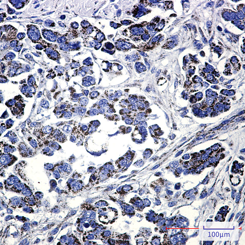 Methylmalonyl Coenzyme A mutase Rabbit mAb ABZ3049