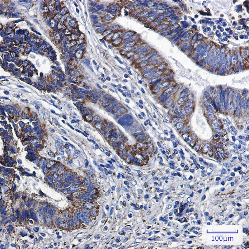 MGST3 Rabbit mAb ABZ3050