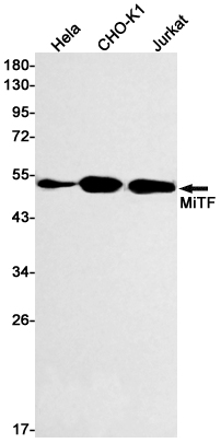 MiTF Rabbit mAb ABZ3053