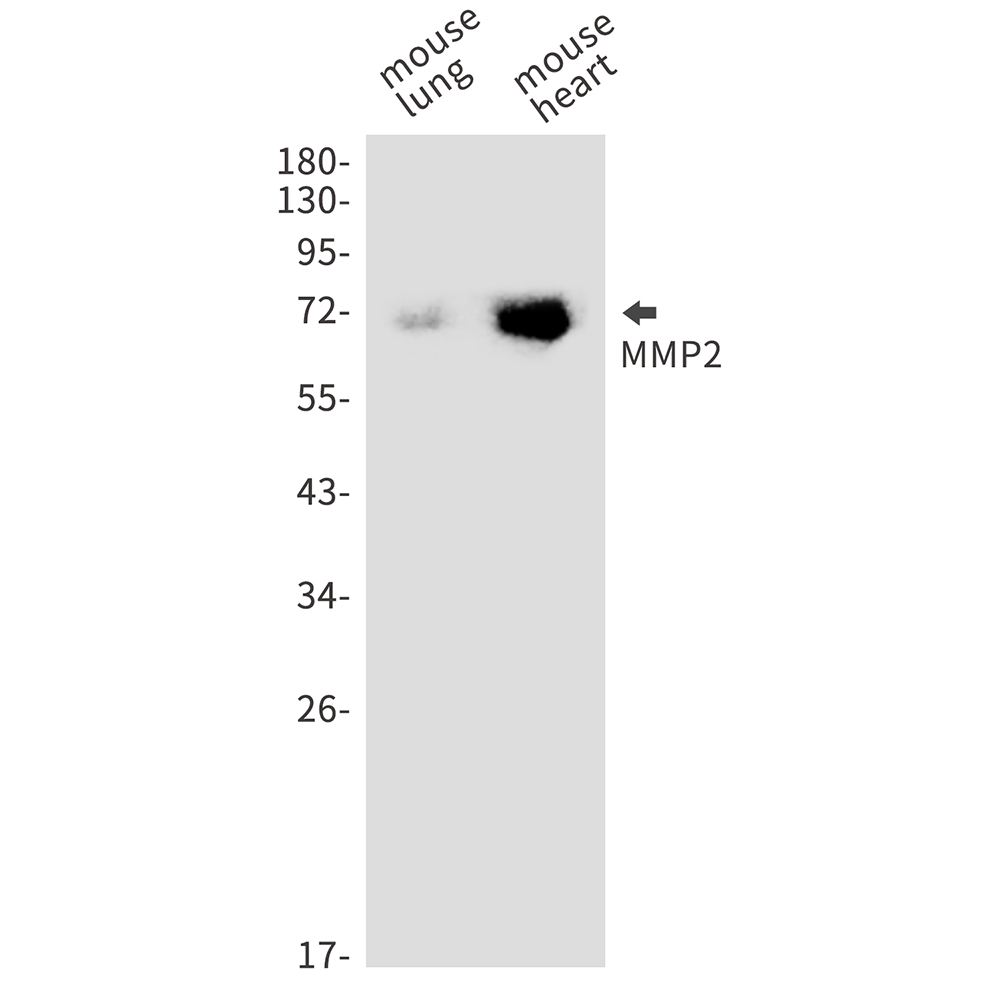 MMP2 Rabbit mAb ABZ3055