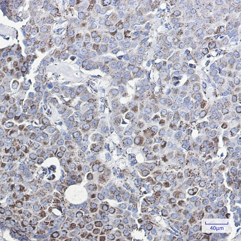 MMP3 Rabbit mAb ABZ3056