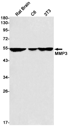 MMP3 Rabbit mAb ABZ3056