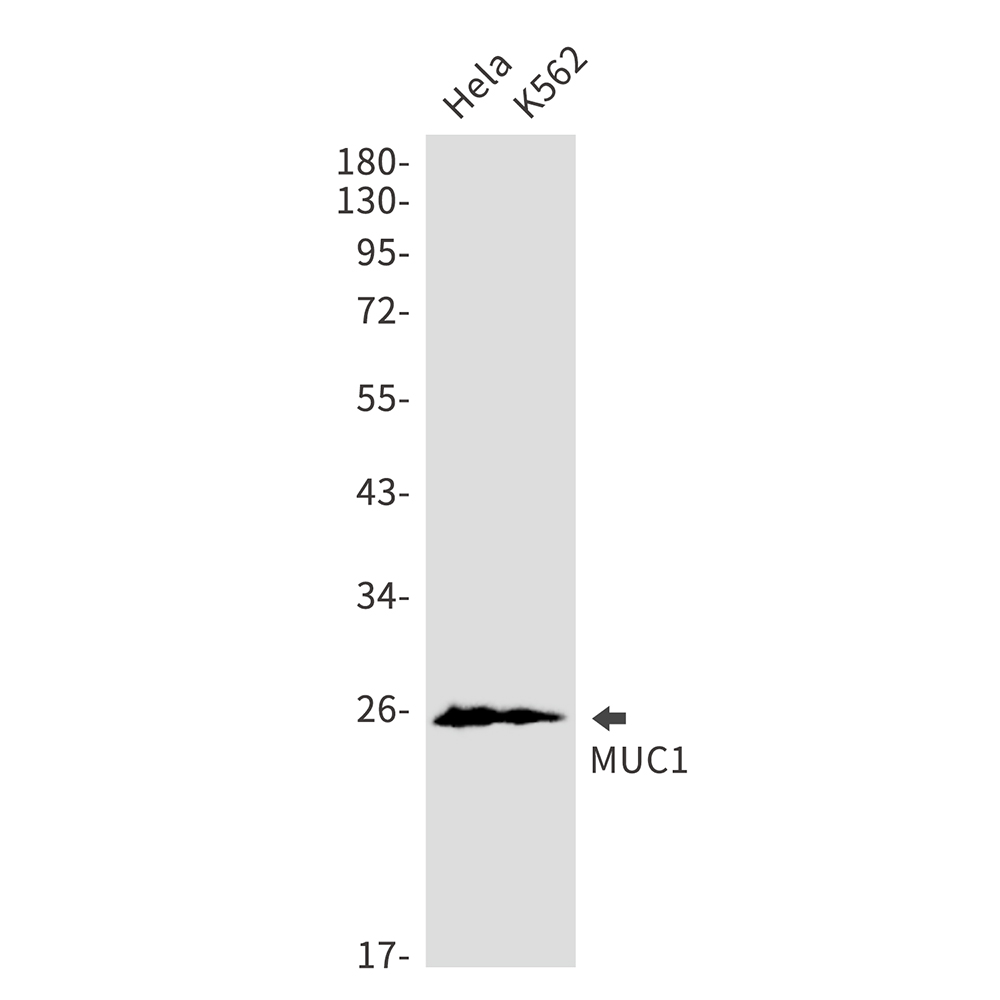 MUC1 Rabbit mAb ABZ3058