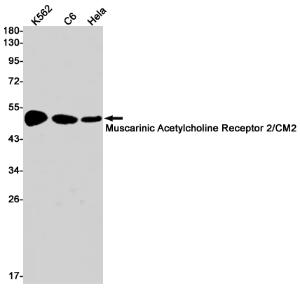 Muscarinic Acetylcholine Receptor M2 Rabbit mAb ABZ3059