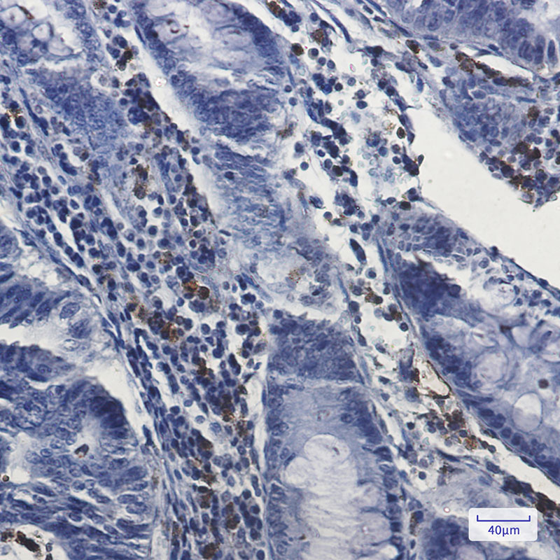 Myeloperoxidase Rabbit mAb ABZ3061