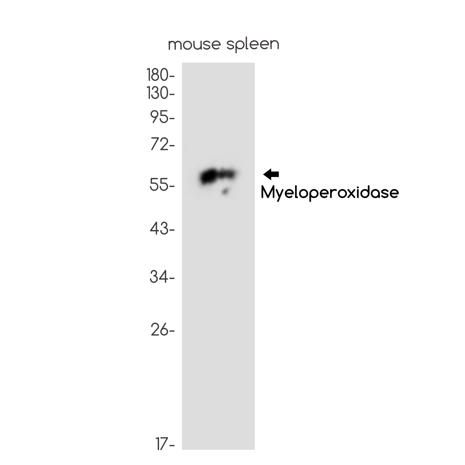 Myeloperoxidase Rabbit mAb ABZ3062