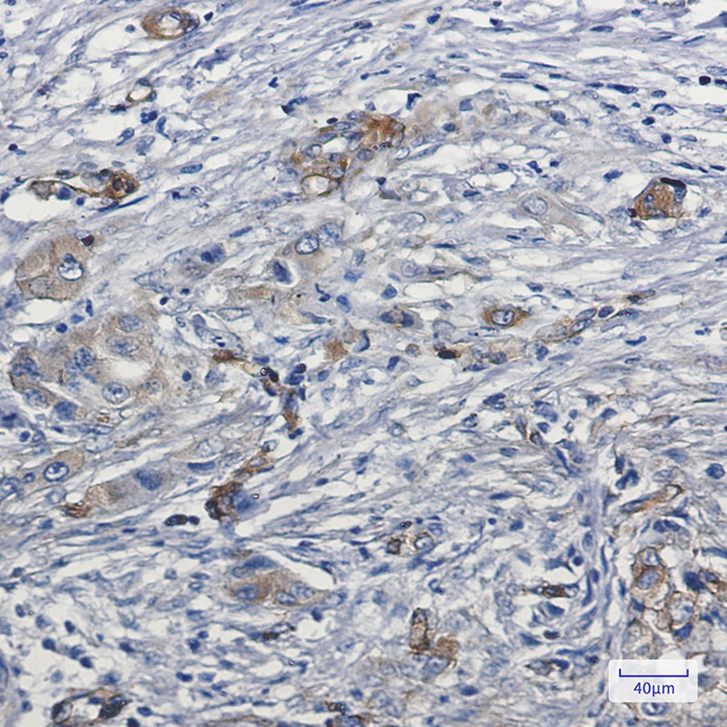 MYO1B Rabbit mAb ABZ3063