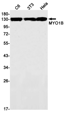 MYO1B Rabbit mAb ABZ3063