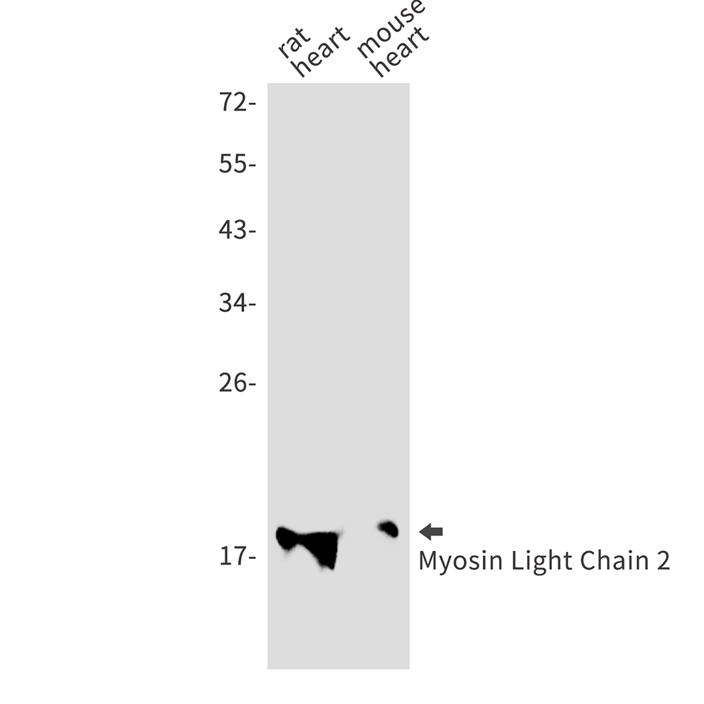 Myosin Light Chain 2 Rabbit mAb ABZ3064
