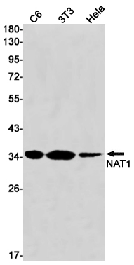 NAT1 Rabbit mAb ABZ3065