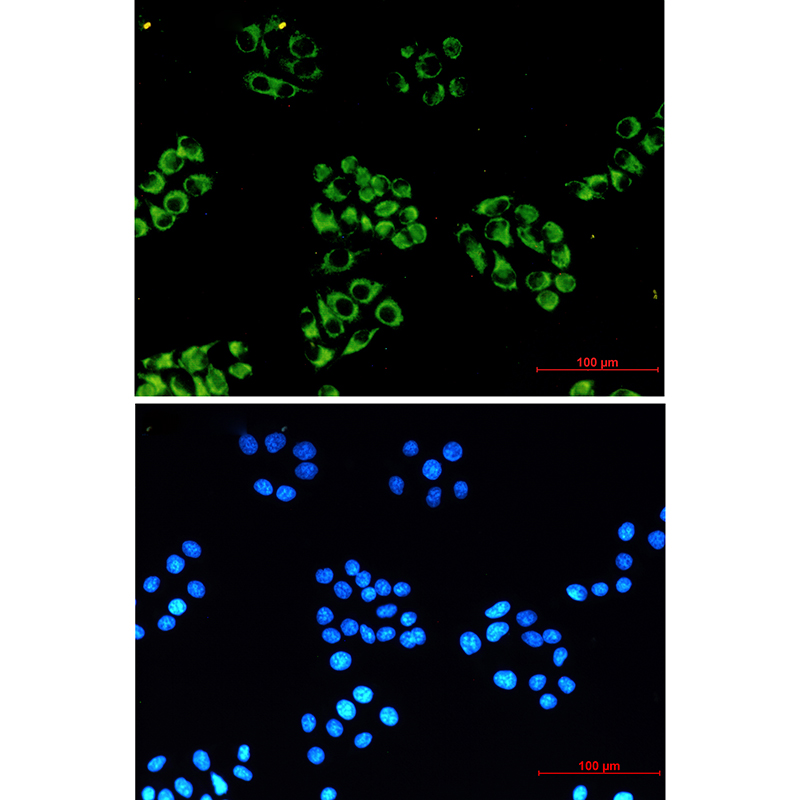 NDUFB10 Rabbit mAb ABZ3068