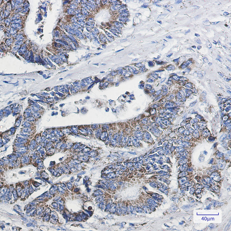 NDUFB10 Rabbit mAb ABZ3068