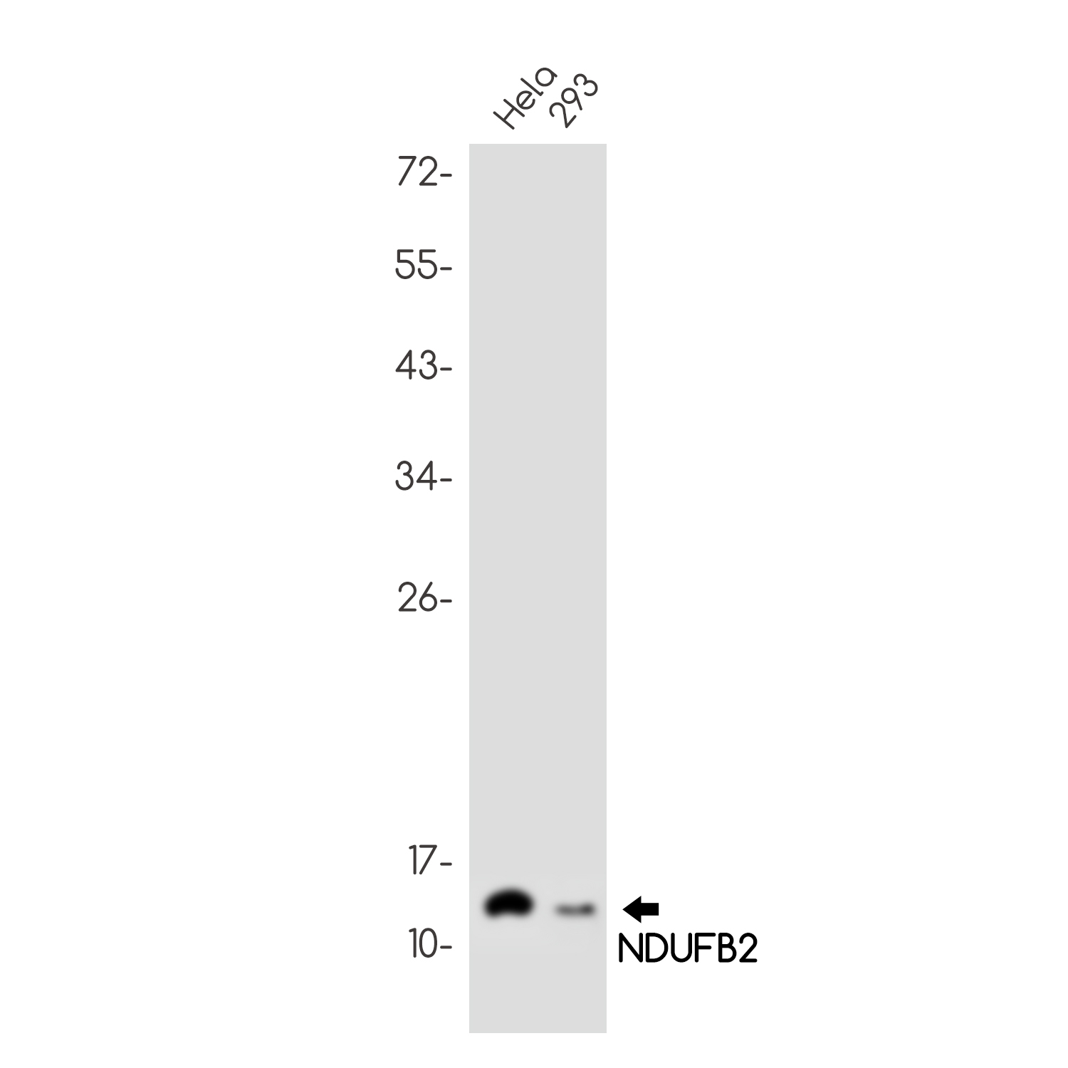 NDUFB2 Rabbit mAb ABZ3069