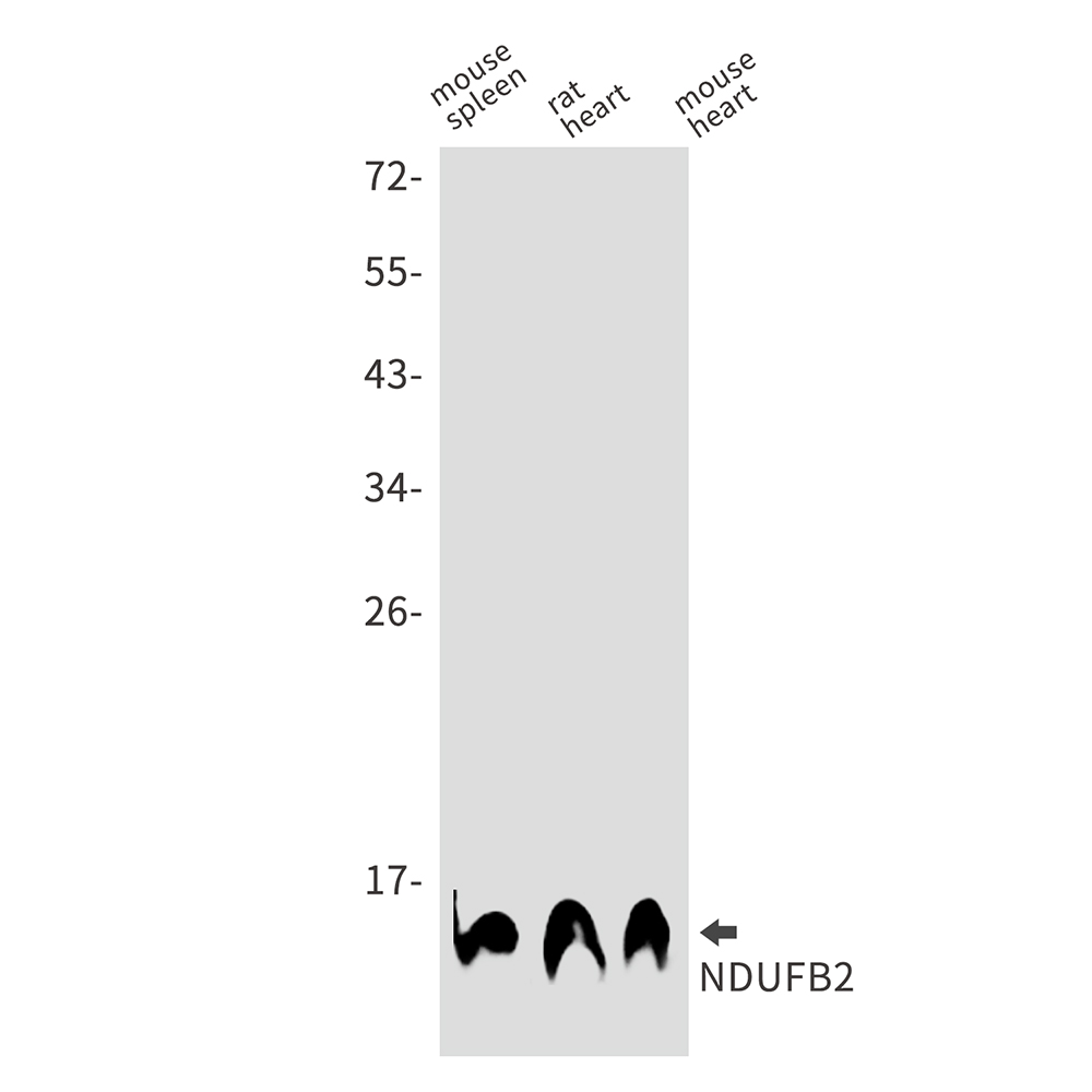 NDUFB2 Rabbit mAb ABZ3069