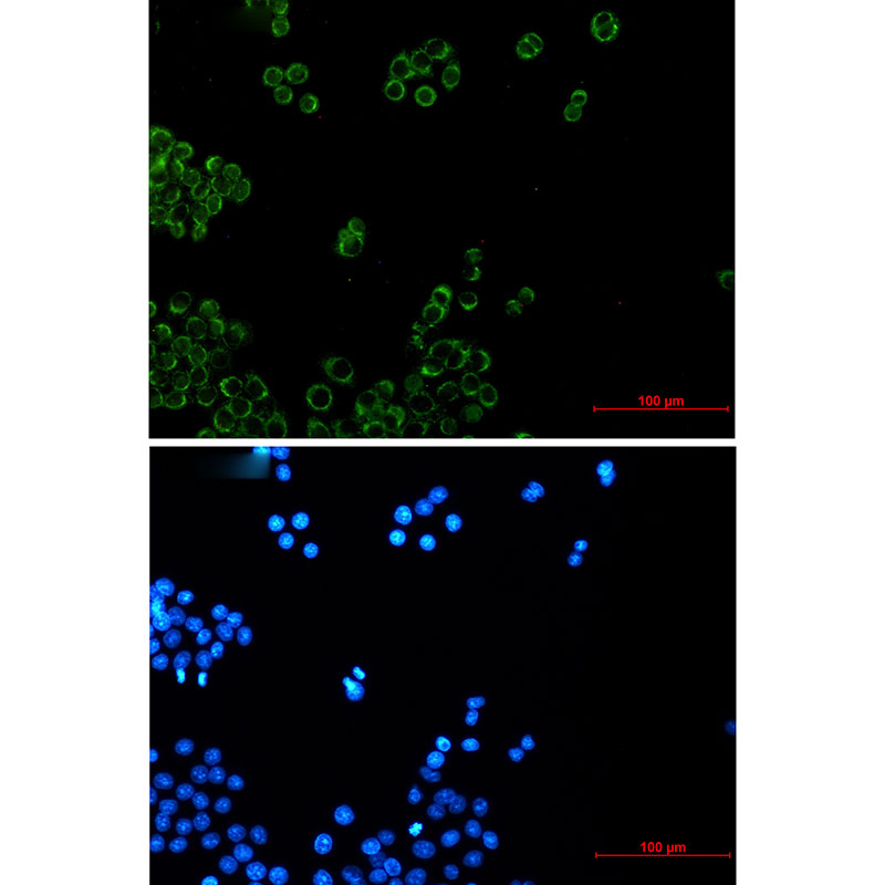 NDUFB4 Rabbit mAb ABZ3070