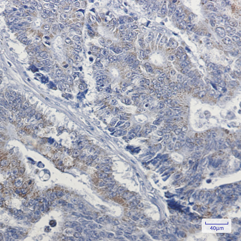 NDUFB4 Rabbit mAb ABZ3070