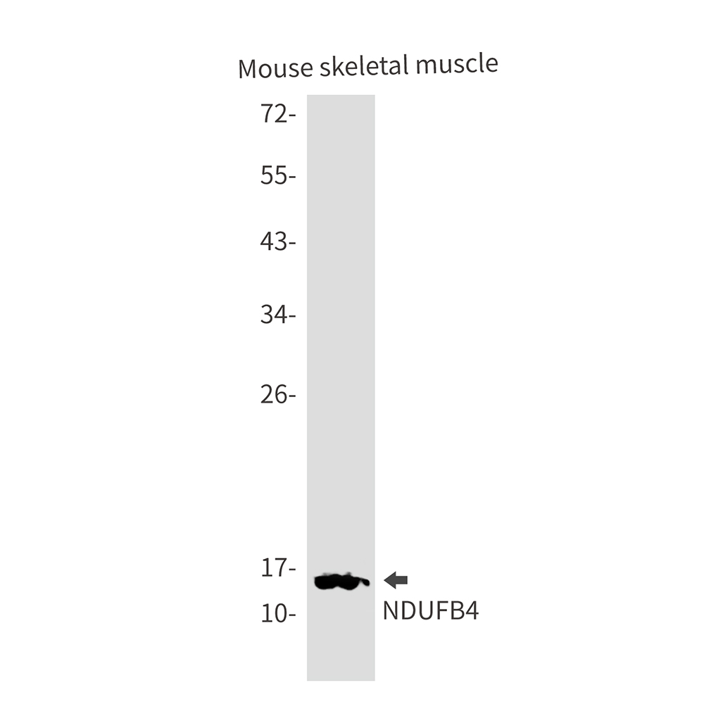 NDUFB4 Rabbit mAb ABZ3070