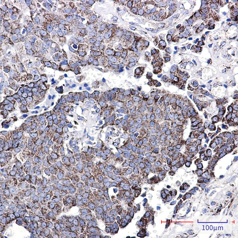 NDUFC2 Rabbit mAb ABZ3071