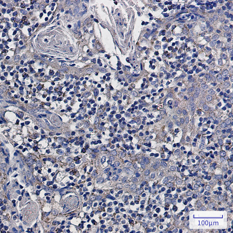 NDUFS6 Rabbit mAb ABZ3073